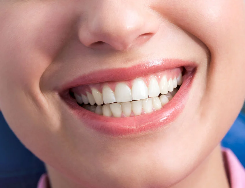 Gum Contouring in Gardena, CA