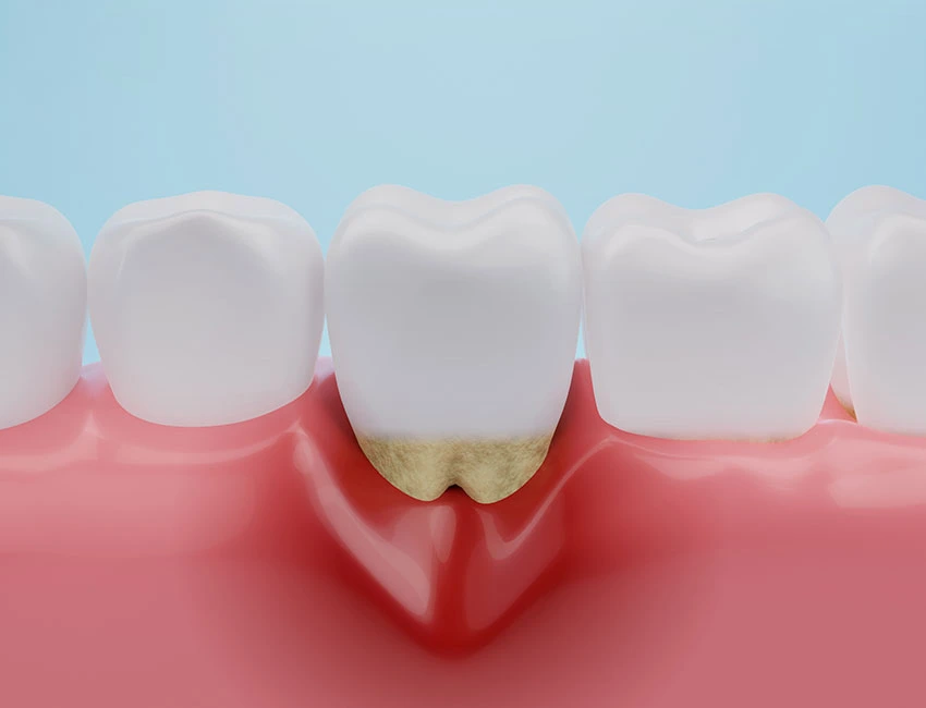 What is Periodontal Care