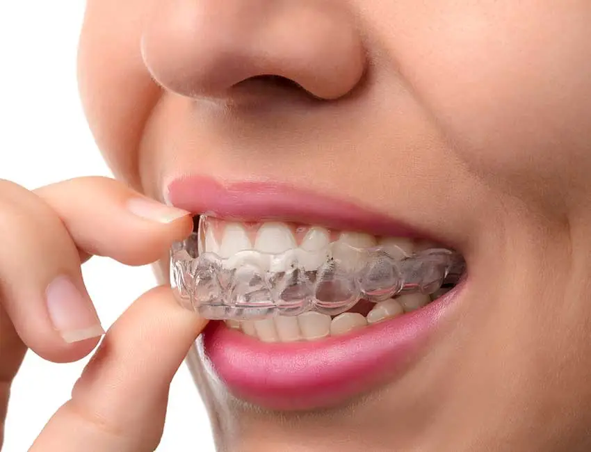 Custom Mouthguards in Gardena, CA