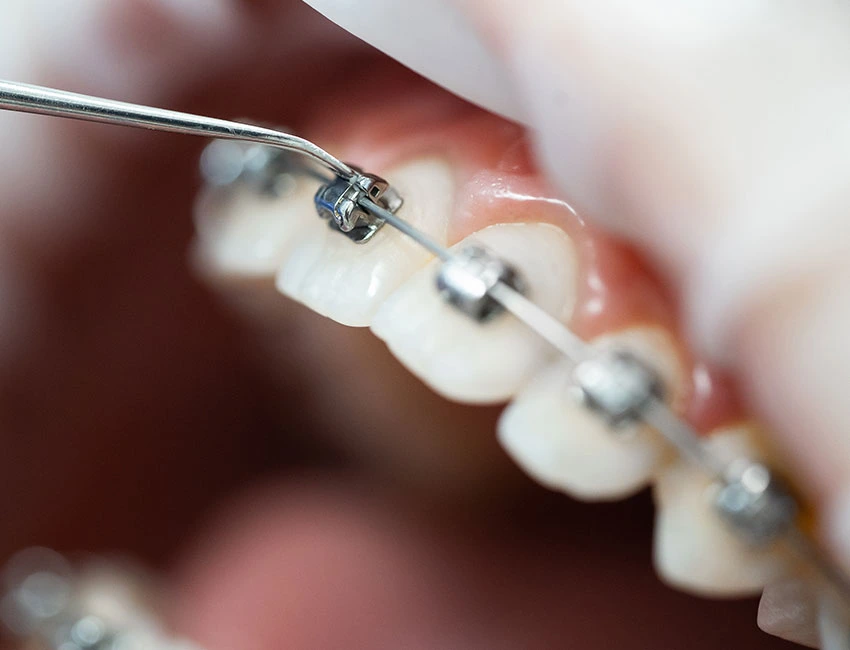 What is orthodontics