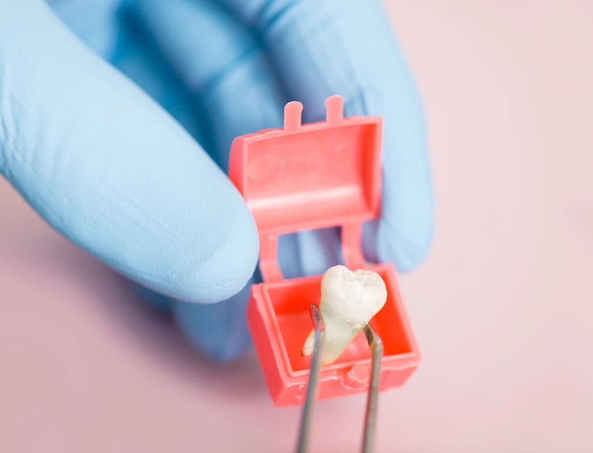 Wisdom Teeth Removal in Gardena, CA