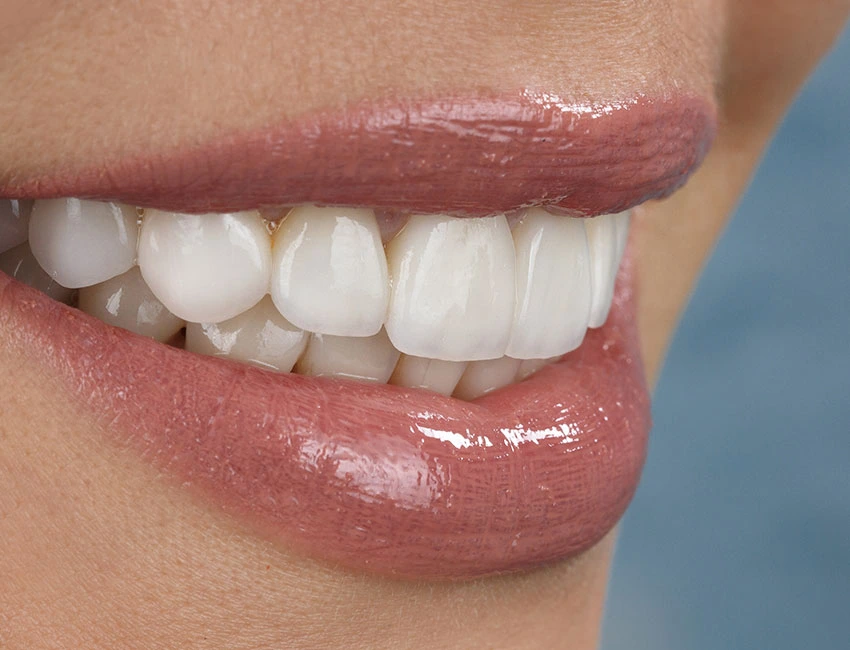 Patient's healthy and stunning smile in Gardena, CA