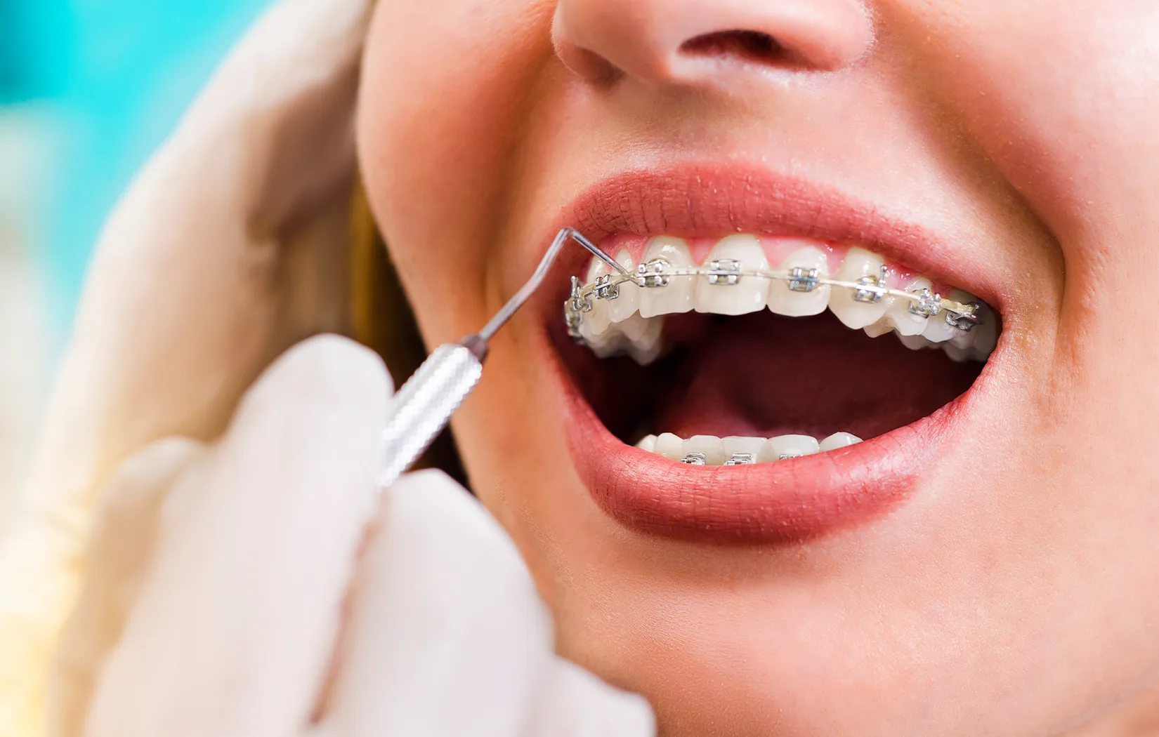 Patient with braces