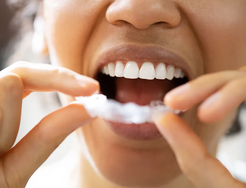 TMJ and Bruxism Treatment in Gardena, CA