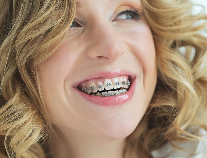 Why choose Gardena Dental Group for orthodontics